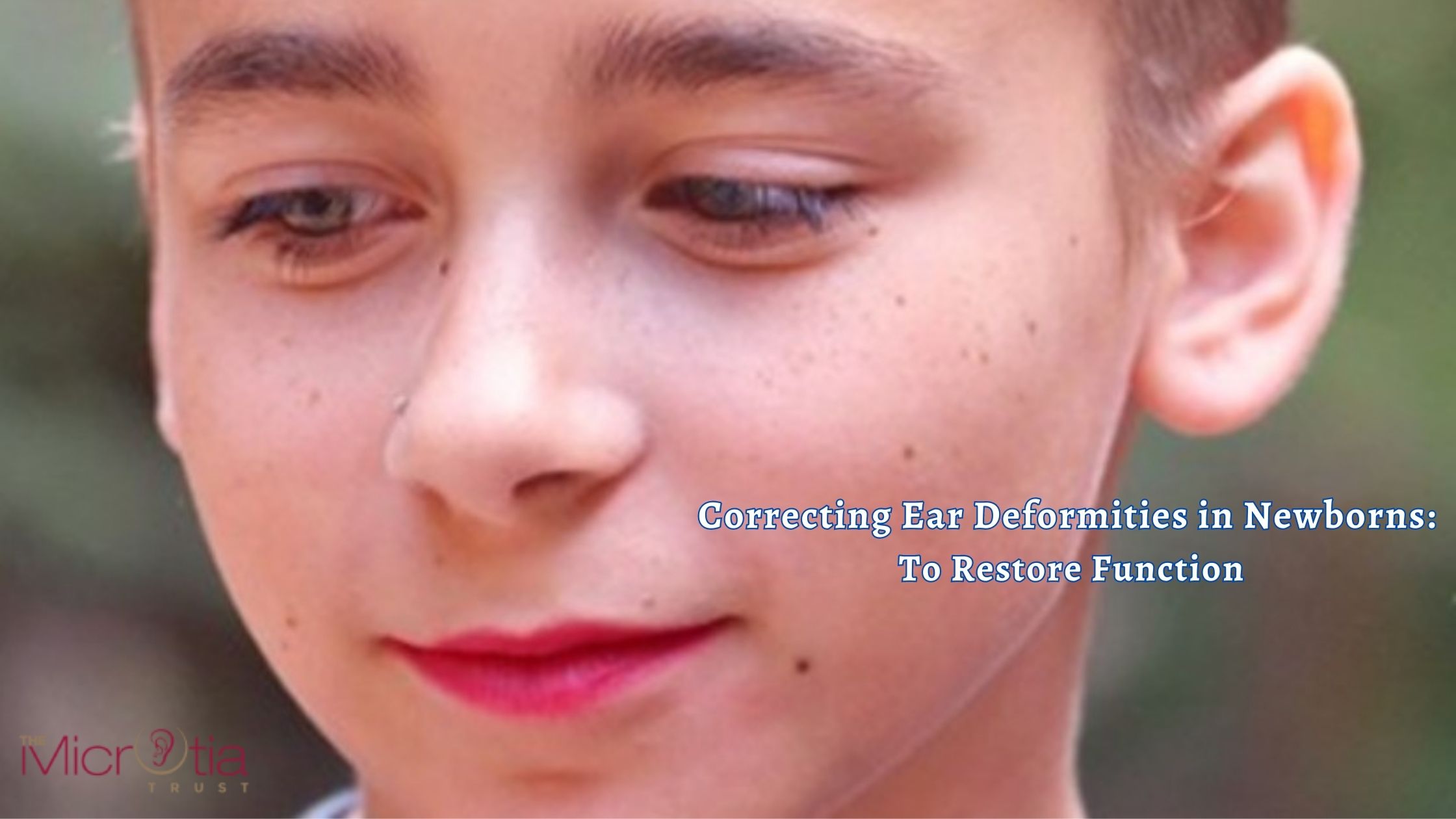 Correcting Ear Deformities in Newborns To Restore Function