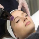 Morpheus8-non-surgical-face-lift-The-Cosmetic-Skin-Clinic-London
