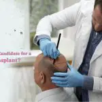 Who is an Ideal Candidate for a Hair Transplant