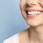 panacea dental implants