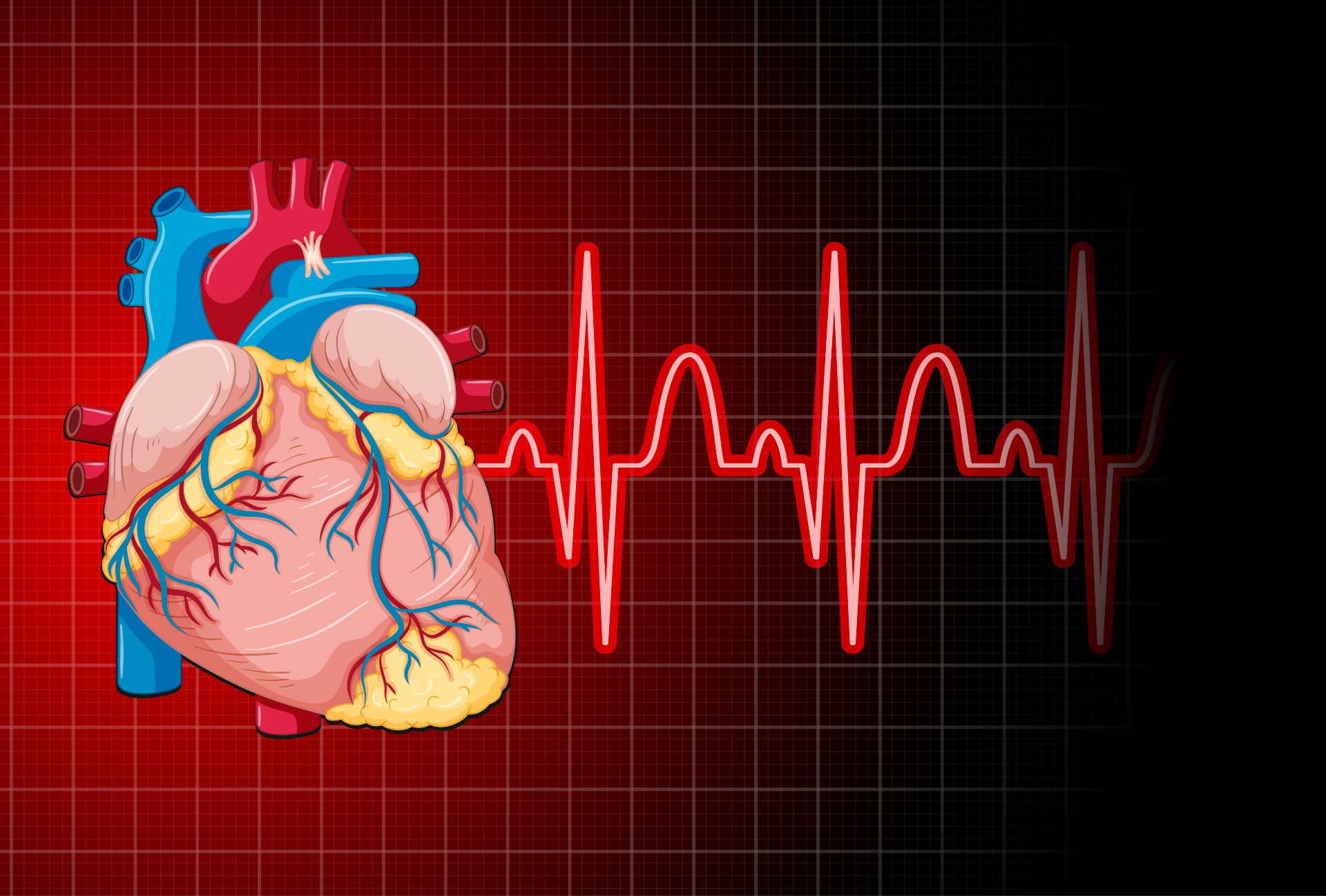 difference between heart attack and stroke