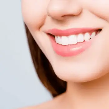 Cosmetic-Dental-Procedures