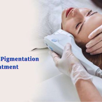 FAQs About Pigmentation Treatment