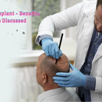 FUE Hair Transplant - Benefits And Steps Discussed