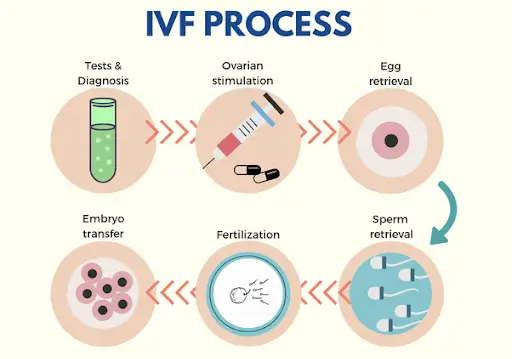 IVF Treatment Process