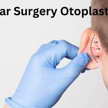 Ear Surgery Otoplasty