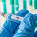 HPV Disease 04