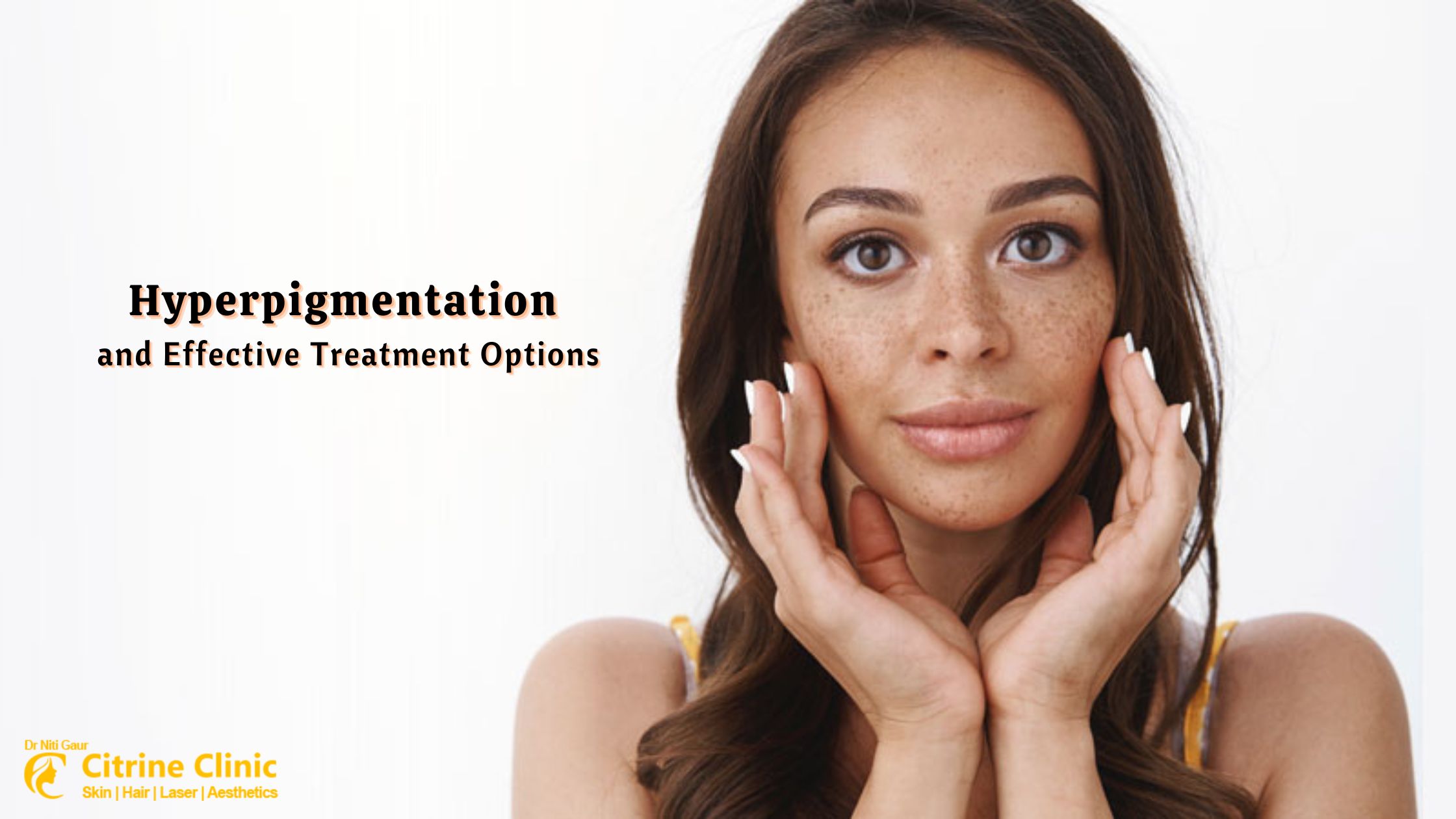 Hyperpigmentation and Effective Treatment Options