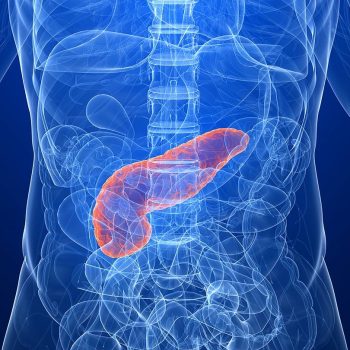 Pancreatic Cancer Therapeutics and Diagnostic Market