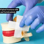 The Treatment of Spinal Fractures with Kyphoplasty and Vertebroplasty