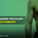 Tips for managing the scars of tummy tuck surgery