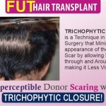 Trichophytic closure - 568x320