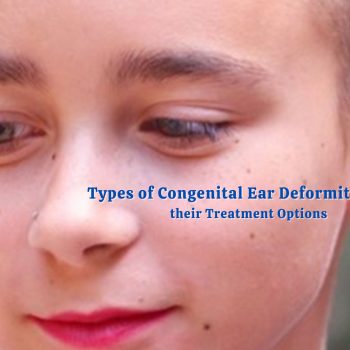 Types of Congenital Ear Deformities and their Treatment Options