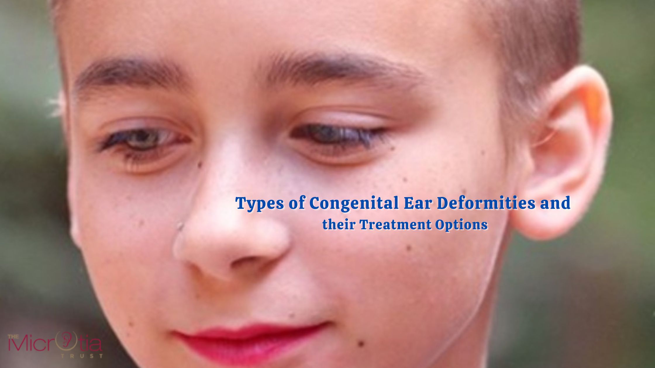 Types of Congenital Ear Deformities and their Treatment Options