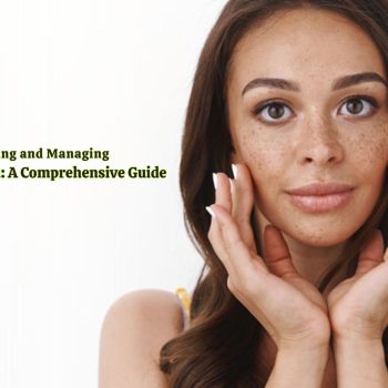Understanding and Managing Hyperpigmentation A Comprehensive Guide