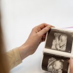 What-Is-4d-Sonography-In-Pregnancy