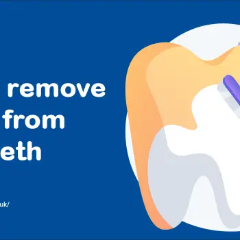 remove Plaque on Your teeth without Tooth Extraction