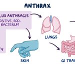 Anthrax Disease 03
