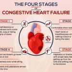 Congestive Heart Failure