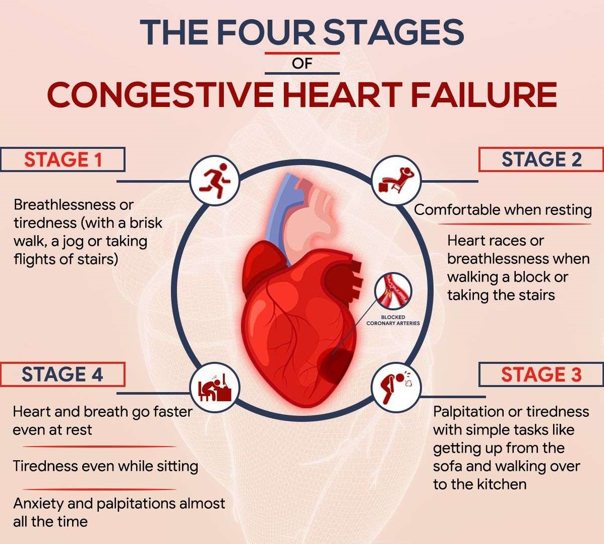 Congestive Heart Failure