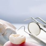 Everything You Should Know About Dental Crowns (1)