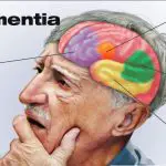 Frontotemporal Dementia02