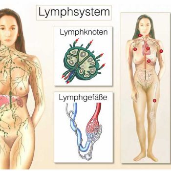 Lymphoma 01