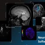 Neurology Software Market
