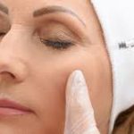 Botox Injections For Wrinkles