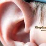 Otoplasty Surgery- When it is performed