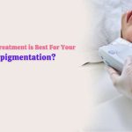 Which Laser Treatment is Best For Your Hyperpigmentation