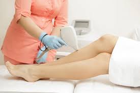 laser hair removal cost