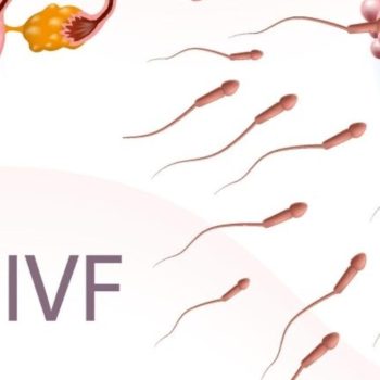 IVF-Centre-in-Indore