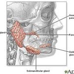 Parotidectomy