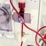 dialysis-machine-2