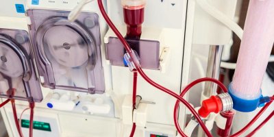 dialysis-machine-2