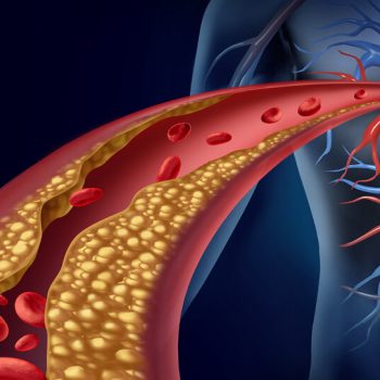 Cholesterol_SOC_1080x540_A