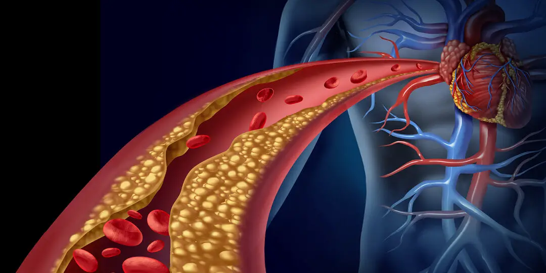 Cholesterol_SOC_1080x540_A