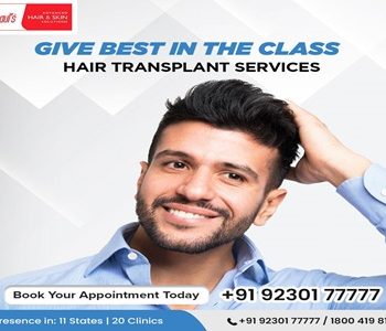 Hair Transplant in Kolkata 4