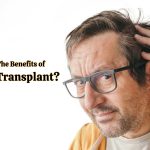 What Are The Benefits of Fut Hair Transplant