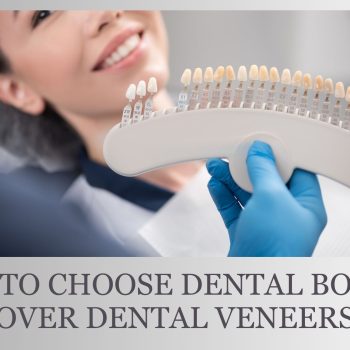 When to Choose Dental Bonding Over Dental Veneers