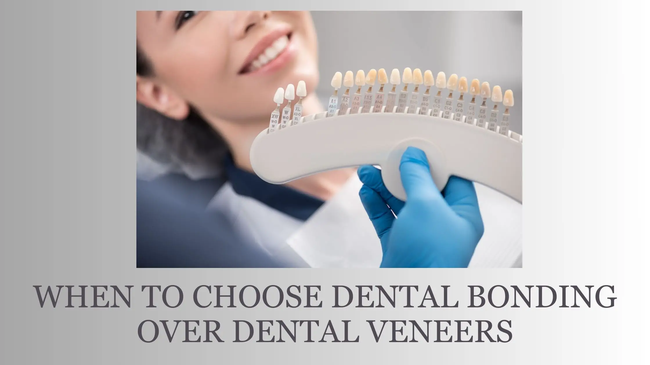 When to Choose Dental Bonding Over Dental Veneers