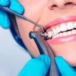 teeth cleaning fort lauderdale