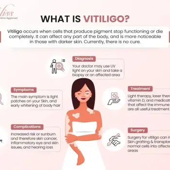 vitiligo-content (1)