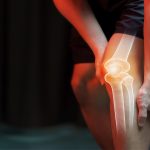 Shockwave Treatment for Knee Pain