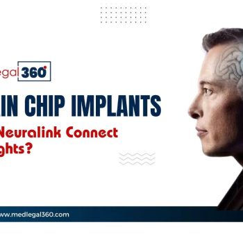 Brain Chip Implants