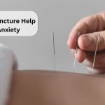 Can Acupuncture Help with Anxiety