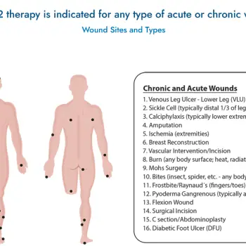 chronic wound