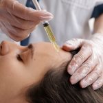 woman-getting-prp-treatment-close-up_23-2149404691