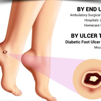 Diabetic Ulcer Treatment Market